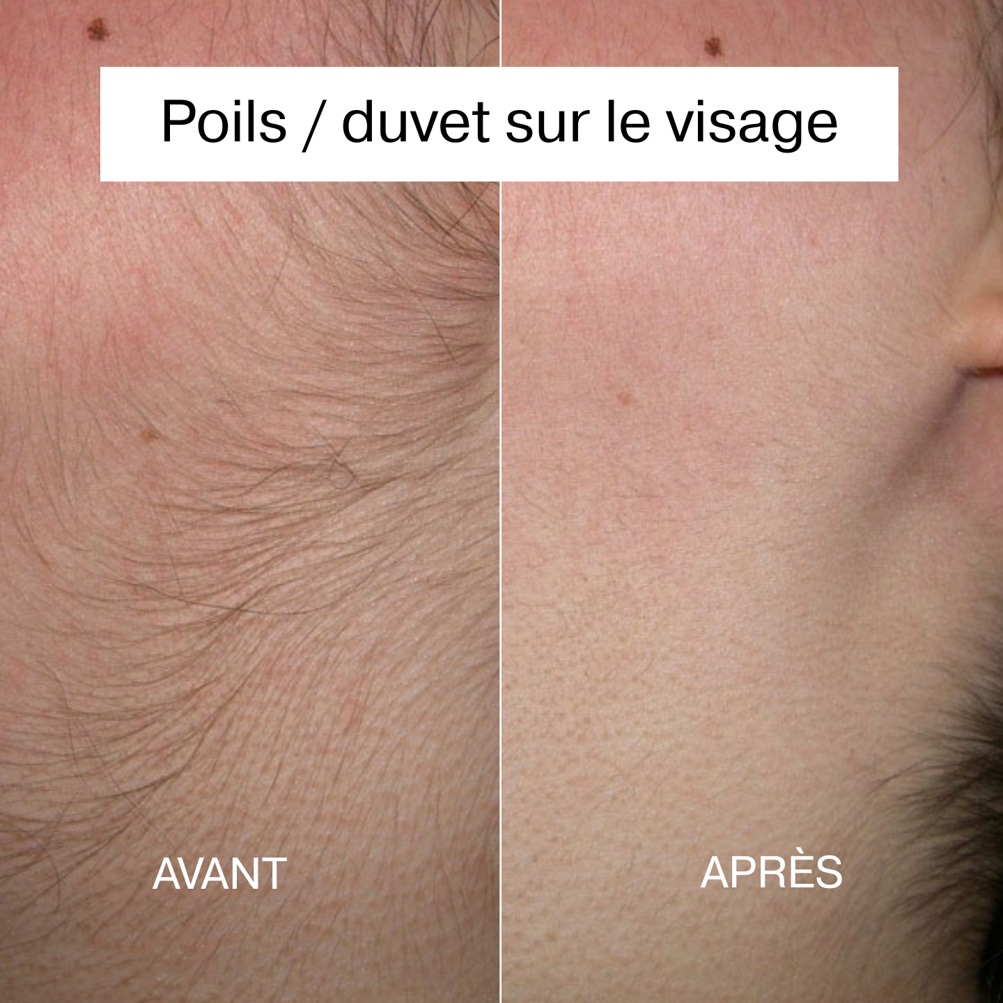 Rasoir 2-en-1 OhLisse®